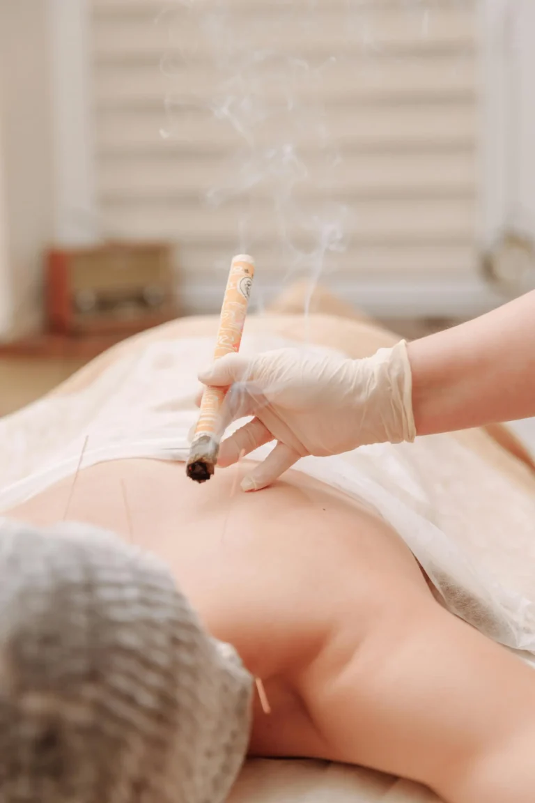 moxibustion-DraMariaLauraSaba